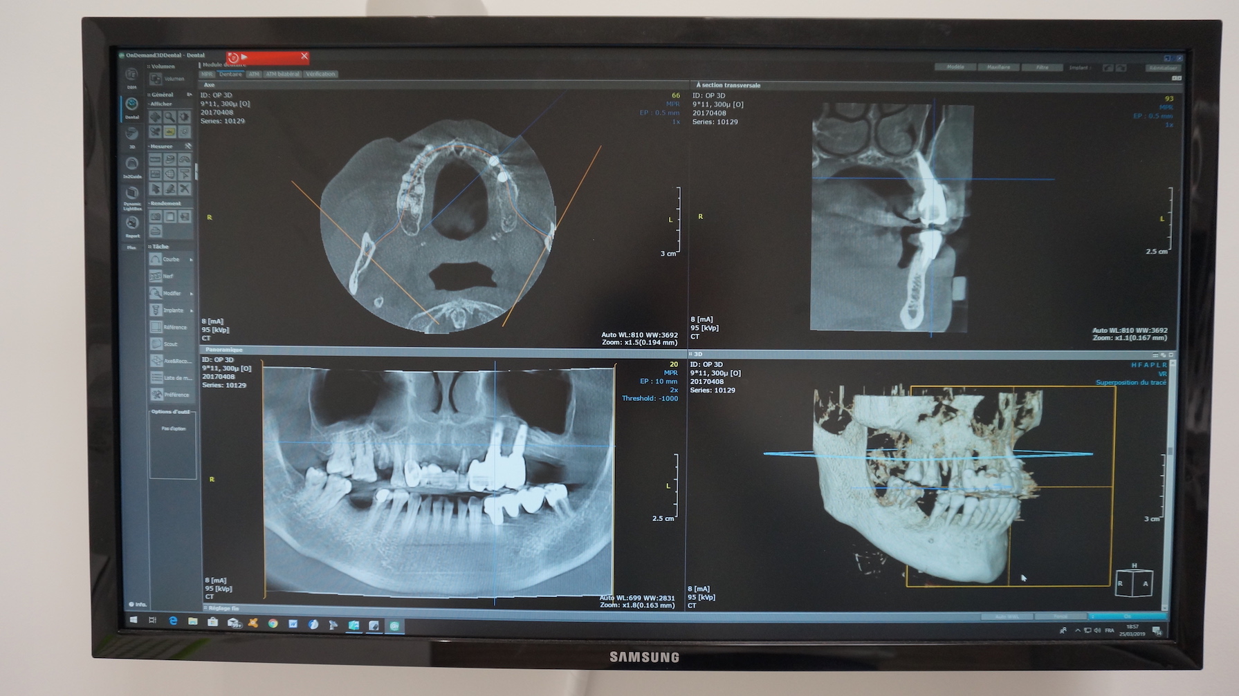 Equipement de radio panoramique